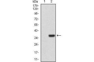 Western blot analysis using IL3RA mAb against HEK293 (1) and IL3RA (AA: 200-305)-hIgGFc transfected HEK293 (2) cell lysate. (IL3RA Antikörper  (AA 200-305))