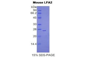 SDS-PAGE (SDS) image for CD2 (CD2) (AA 23-203) protein (His tag) (ABIN1877367) (CD2 Protein (CD2) (AA 23-203) (His tag))