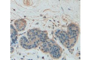 Used in DAB staining on fromalin fixed paraffin- embedded breast tissue (PLIN4 Antikörper  (AA 349-656))