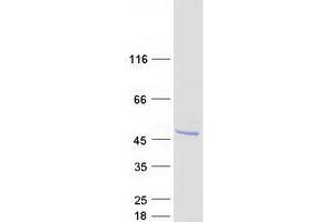 Validation with Western Blot (ASB6 Protein (Transcript Variant 1) (Myc-DYKDDDDK Tag))