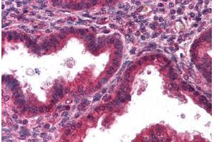 Human Uterus, Endometrium (formalin-fixed, paraffin-embedded) stained with DCN antibody ABIN298189 at 2. (Decorin Antikörper)