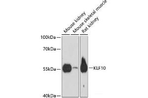 Western blot analysis of extracts of various cell lines using KLF10 Polyclonal Antibody at dilution of 1:3000. (KLF10/TIEG1 Antikörper)