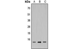 Western blot analysis of SH2D1A expression in HEK293T (A), Raw264.