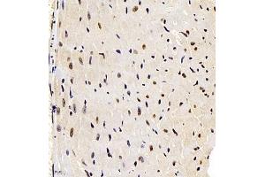 Immunohistochemistry of paraffin embedded mouse heart using smad62024 (ABIN7075629) at dilution of 1:1000 (400x lens)