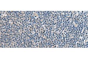Immunohistochemistry of paraffin-embedded Human tonsil tissue using CNTN4 Polyclonal Antibody at dilution of 1:65(x200) (Contactin 4 Antikörper)