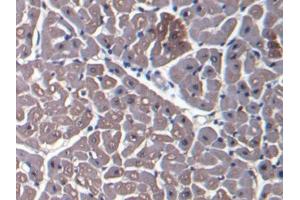 DAB staining on IHC-P; Samples: Bovine Cardiac Muscle Tissue (Myoglobin Antikörper  (AA 1-154))