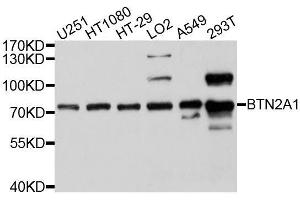 Western blot analysis of extracts of various cell lines, using BTN2A1 antibody. (BTN2A1 Antikörper  (AA 30-240))