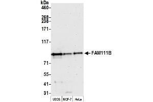anti-Family with Sequence Similarity 111, Member B (FAM111B) (AA 225-275) antibody