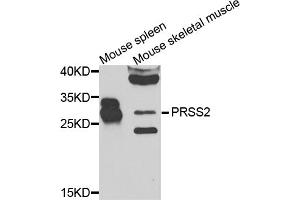 Western blot analysis of extracts of various cell lines, using PRSS2 antibody. (PRSS2 Antikörper)