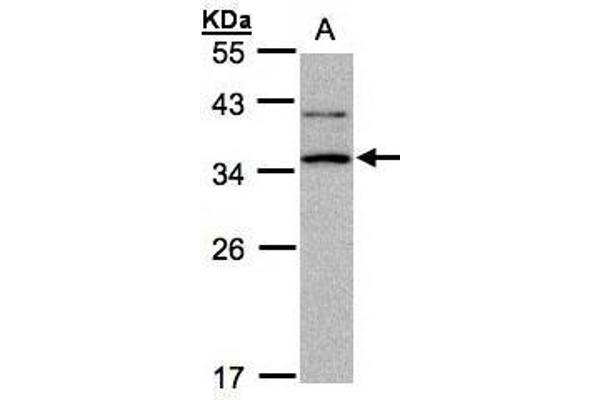 XRCC2 Antikörper  (N-Term)