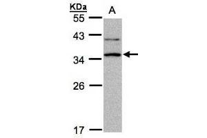 WB Image Sample A: 30μg of Raji whole cell lysate , 12% SDS PAGE antibody diluted at 1:1000 (XRCC2 Antikörper  (N-Term))