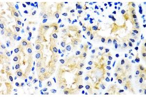 Immunohistochemistry of paraffin-embedded Mouse kidney using SNAP29 Polyclonal Antibody at dilution of 1:100 (40x lens). (SNAP29 Antikörper)