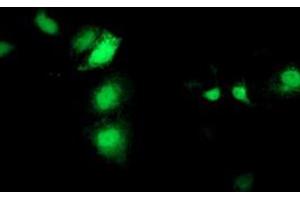 Anti-SEC14L2 mouse monoclonal antibody (ABIN2455150) immunofluorescent staining of COS7 cells transiently transfected by pCMV6-ENTRY SEC14L2 (RC215994). (SEC14L2 Antikörper)