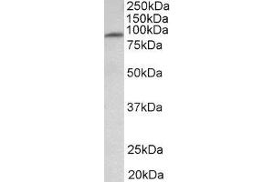 ABIN2563856 (1µg/ml) staining of Human Heart lysate (35µg protein in RIPA buffer). (MFSD6 Antikörper  (Internal Region))