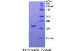SDS-PAGE analysis of Human TAF12 Protein.