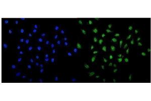 IF analysis of MED13 using anti-MED13 antibody (ABIN5519033).