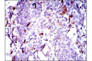 Immunohistochemistry (IHC) image for anti-Osteoactivin (GPNMB) (AA 31-260) antibody (ABIN1724859)