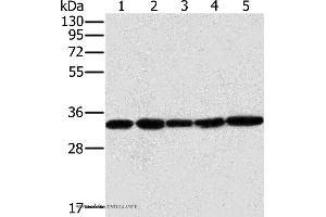 Western blot analysis of Human testis tissue and K562 cell, PC3 cell and human liver cancer tissue, hela cell, using MTCH2 Polyclonal Antibody at dilution of 1:400 (MTCH2 Antikörper)