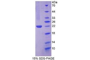 SDS-PAGE (SDS) image for TNF Like Ligand 1A (AA 70-230) protein (His tag) (ABIN2127218) (TNF Like Ligand 1A (AA 70-230) protein (His tag))