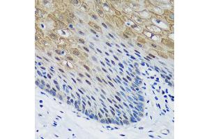 Immunohistochemistry of paraffin-embedded Human esophageal using PSPC1 Rabbit pAb (ABIN6132925, ABIN6146363, ABIN6146364 and ABIN6224928) at dilution of 1:100 (40x lens). (PSPC1 Antikörper  (AA 1-70))