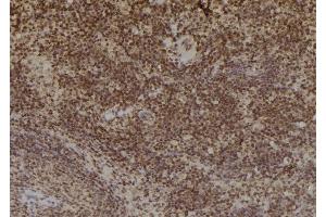ABIN6269033 at 1/100 staining Mouse spleen tissue by IHC-P. (TYR Antikörper)