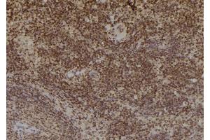 ABIN6269033 at 1/100 staining Mouse spleen tissue by IHC-P.