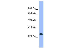 PNOC antibody used at 1 ug/ml to detect target protein. (PNOC Antikörper  (Middle Region))