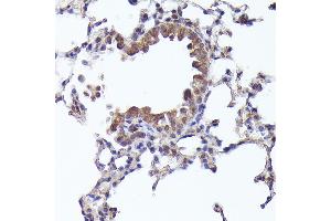 Immunohistochemistry of paraffin-embedded mouse lung using CRCP Rabbit pAb (ABIN1679351, ABIN3019127, ABIN3019128 and ABIN6220728) at dilution of 1:200 (40x lens). (CRCP Antikörper  (AA 1-115))