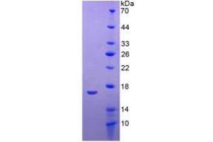 SDS-PAGE of Protein Standard from the Kit (Highly purified E. (APOA1 CLIA Kit)