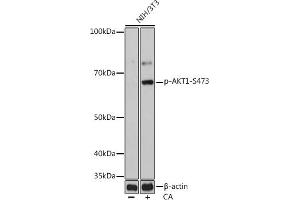 Western blot analysis of extracts of NIH/3T3 cells, using Phospho--S473 mAb (ABIN6135179, ABIN6135970, ABIN6135971 and ABIN7101880) at 1:1000 dilution. (AKT1 Antikörper  (pSer473))