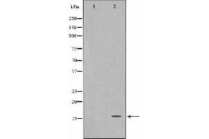 Western blot analysis on A549 cell lysate using FHIT Antibody,The lane on the left is treated with the antigen-specific peptide. (FHIT Antikörper  (Internal Region))