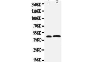 Anti-Leupaxin antibody, Western blotting Lane 1: Rat Thymus Tissue Lysate Lane 2: JURKAT Cell Lysate (Leupaxin Antikörper  (N-Term))