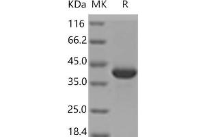 Western Blotting (WB) image for Malate Dehydrogenase 1, NAD (Soluble) (MDH1) protein (His tag) (ABIN7321179) (MDH1 Protein (His tag))
