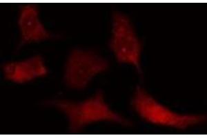ABIN6275326 staining  HT29 cells by IF/ICC. (NUSAP1 Antikörper  (C-Term))