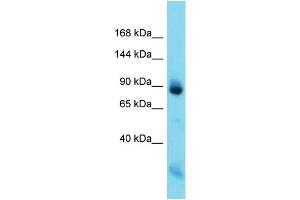 Host: Rabbit  Target Name: Nefm  Sample Tissue: Rat Muscle lysates  Antibody Dilution: 1. (NEFM Antikörper  (C-Term))