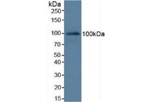 Detection of C7 in Rat Serum using Polyclonal Antibody to Complement Component 7 (C7) (C7 Antikörper  (AA 1-144))