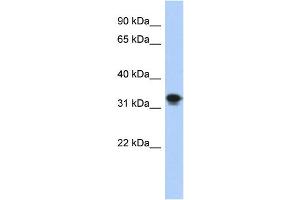 WB Suggested Anti-CENPP Antibody Titration: 0. (CENPP Antikörper  (N-Term))