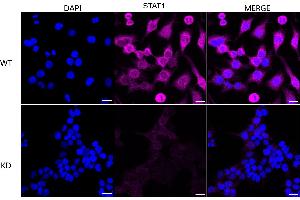 Immunocytochemical staining of HeLa cells using STAT1 antibody (ABIN7800336), 1:1,000), Top panel: wild-type (WT), Bottom panal: STAT1 shRNA knockdown (KD). (Rekombinanter STAT1 Antikörper)