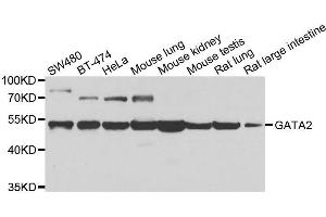 Western blot analysis of extracts of various cell lines, using GATA2 antibody. (GATA2 Antikörper  (AA 1-300))