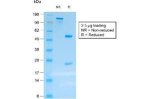 SDS-PAGE Analysis Purified Chromogranin A Mouse Recombinant Monoclonal Ab (rCHGA/413). (Rekombinanter Chromogranin A Antikörper)