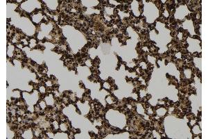ABIN6264405 and ABIN6274040 at 1/100 staining Mouse lung tissue by IHC-P. (PRC1 Antikörper  (Internal Region))