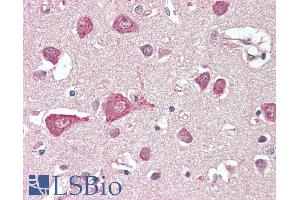 ABIN1590116 (5µg/ml) staining of paraffin embedded Human Cortex. (MLC1 Antikörper  (AA 179-193))
