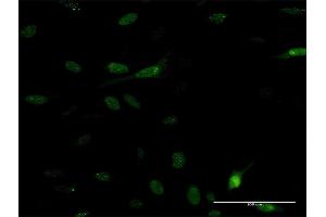 Immunofluorescence of monoclonal antibody to PDE5A on HeLa cell. (PDE5A Antikörper  (AA 29-138))