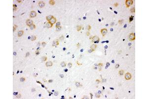Anti-PAK6 antibody, IHC(P) IHC(P): Rat Brain Tissue (PAK6 Antikörper  (N-Term))