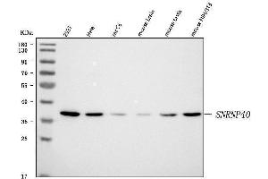 Western blot analysis of SNRNP40 using anti-SNRNP40 antibody (ABIN7601719). (SNRNP40 Antikörper  (AA 43-357))