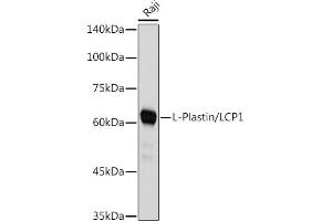 Western blot analysis of extracts of Raji cells, using L-Plastin/LCP1 antibody (ABIN7268317) at 1:1000 dilution. (LCP1 Antikörper)