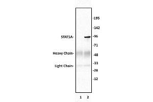 STAT5A antibody (pAb) tested by Immunoprecipitation. (STAT5A Antikörper  (C-Term))