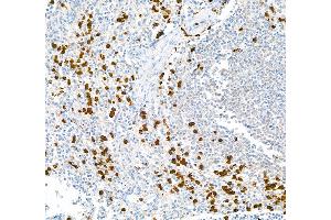 Immunohistochemistry (IHC) image for anti-S100 Calcium Binding Protein A9 (S100A9) (AA 64-114) antibody (ABIN7449432) (Rekombinanter S100A9 Antikörper  (AA 64-114))