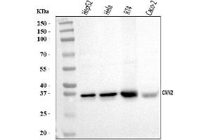 Western blot analysis of Calponin 2/CNN2 using anti-Calponin 2/CNN2 antibody (ABIN7602856).