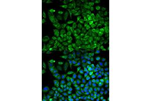 Immunofluorescence analysis of A549 cell using ALDOA antibody. (ALDOA Antikörper)